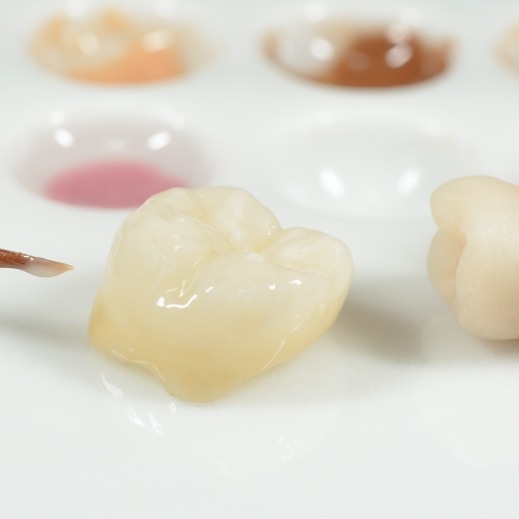 Dental crown before placement during restorative dentistry visit