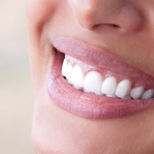 Closeup of beautiful smile after cosmetic dentistry in Garland