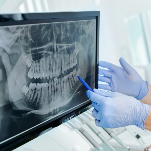 Dentist looking at digital x-rays